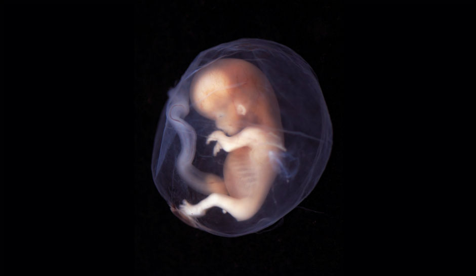 human embryo genetically modified